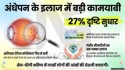 स्टेम सेल से रेटिना की रक्त वाहिकाएं दोबारा बनाने में सफलता, अंधेपन के इलाज की दिशा में नई उम्मीद